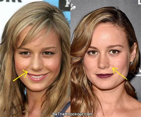 brie larson blow job|Brie Larson Plastic Surgery Comparison Photos